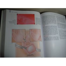 Essentials of Obstetrics and Gynecology, Hacker - Moore